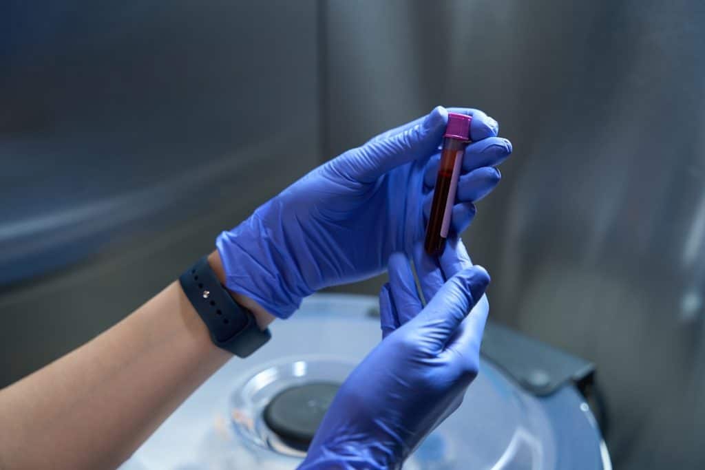 thyroid-labs
