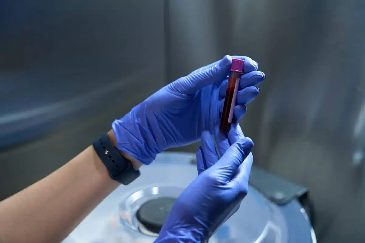 HRT Blog 12 thyroid-labs